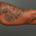 Inmode Morpheus8 Portable 2 in 1 avvu Inmode Morpheus8 Portable 2 in 1 avvu