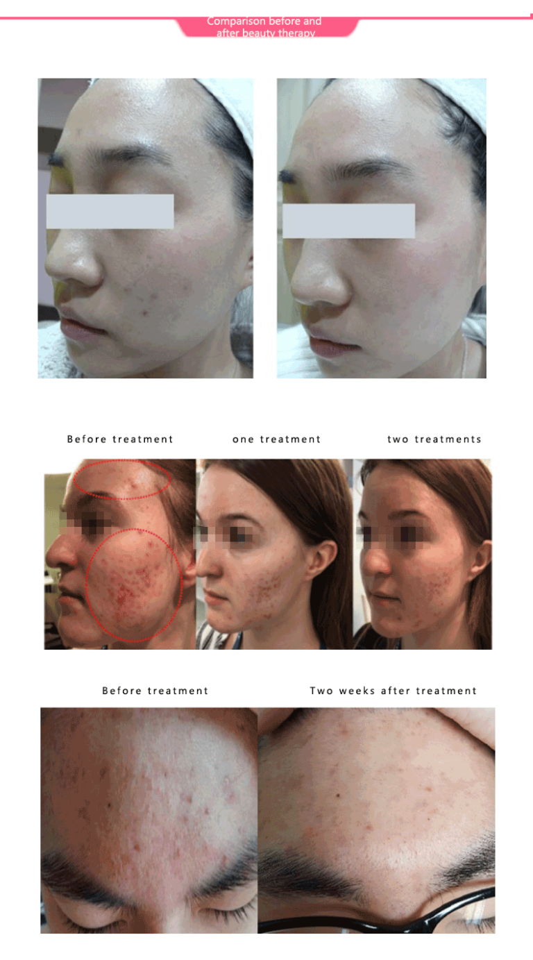 B Type Space Plasma Instrument hwmn