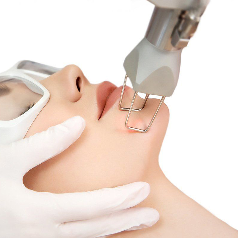 fractional co2 laser