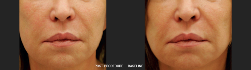 Clinical Outcomes 4231