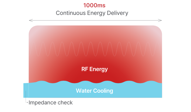 Continuous Water Cooling