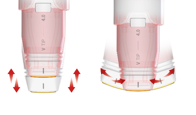 Curved & Tilted Tip Head