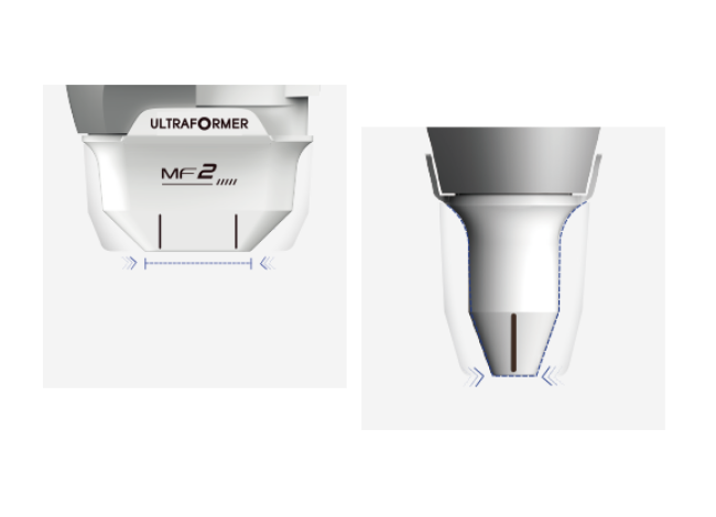 MF2 specifically for forehead, eyes and mouth wrinkles 4227