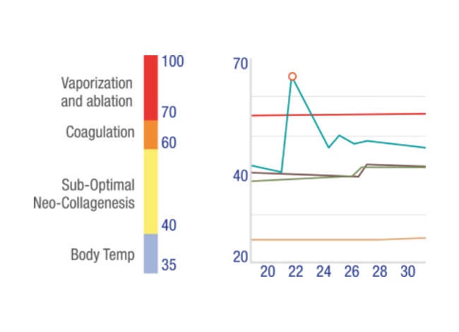 MMFU thermal energy with dual engine power 4230