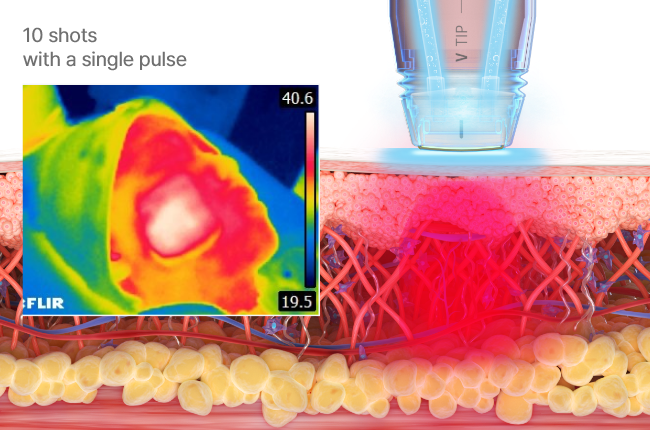 Single Pulse & Real Time Impedance Detection